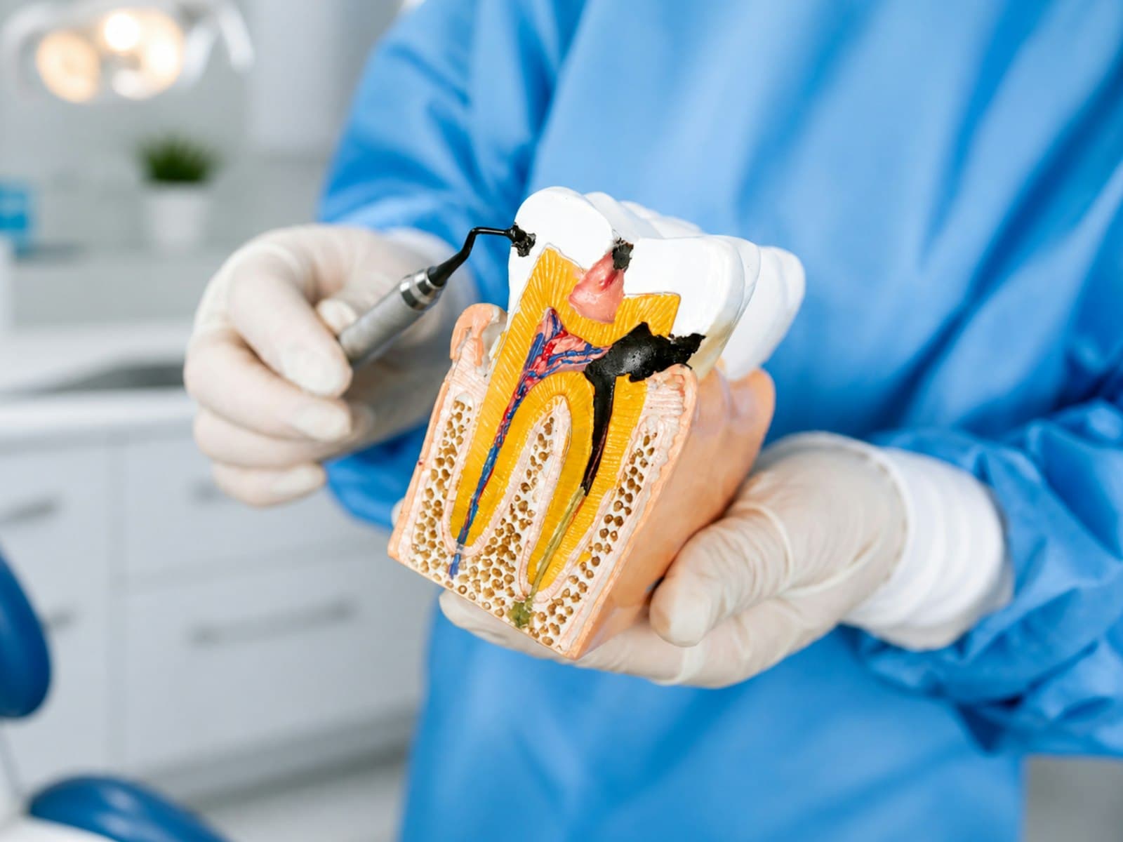 Explaining treatment on a model