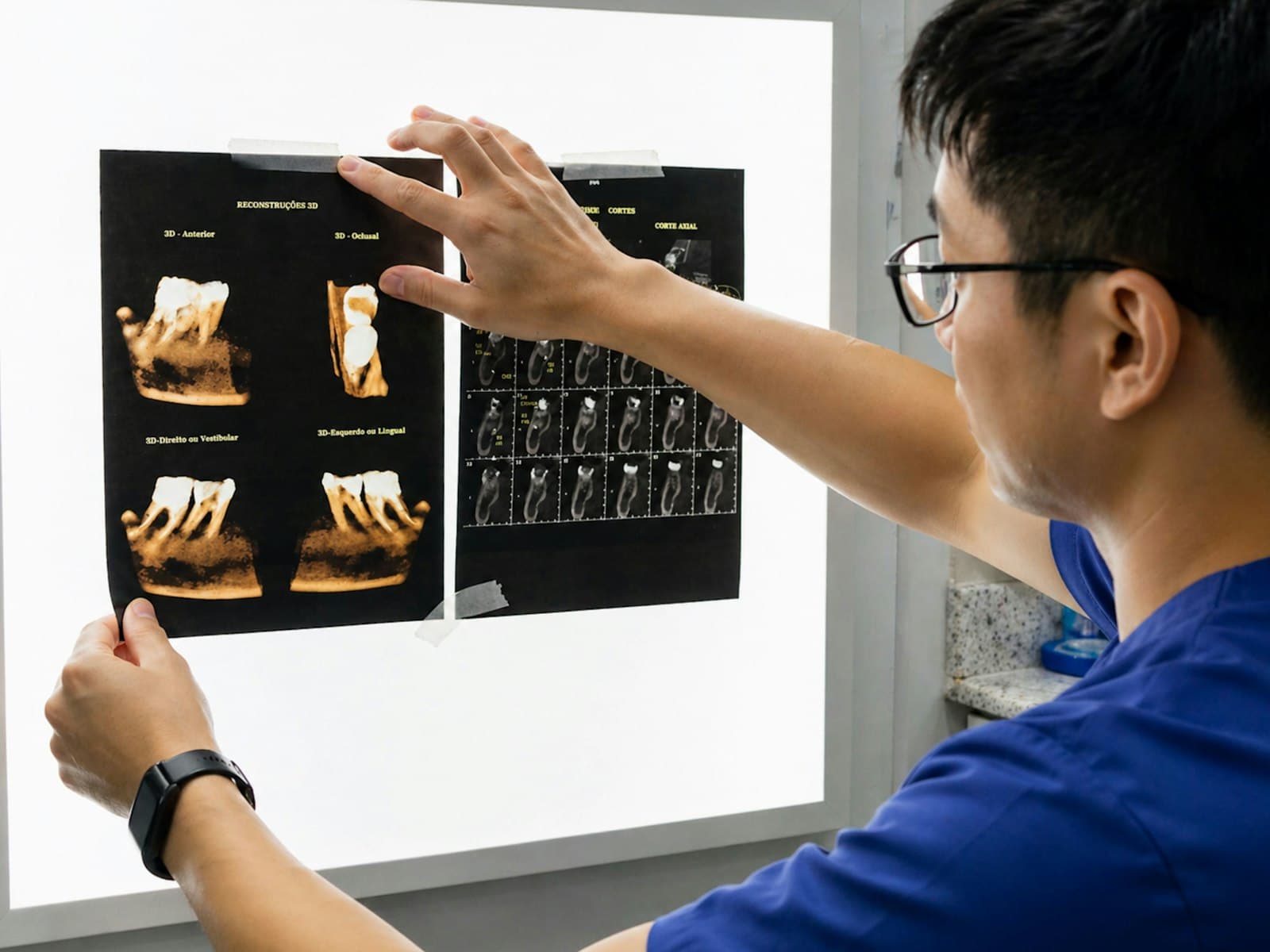 Reviewing radiographs on a lightbox